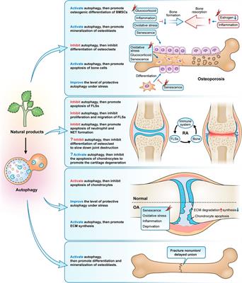 Autophagy: An important target for natural products in the treatment of bone metabolic diseases